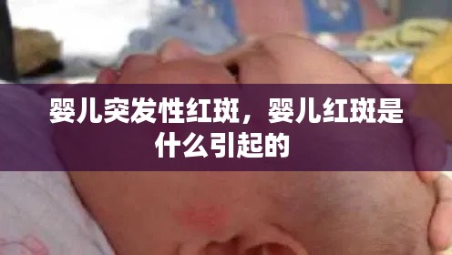 嬰兒突發(fā)性紅斑，嬰兒紅斑是什么引起的 