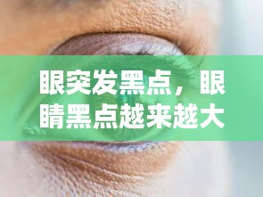 眼突發(fā)黑點(diǎn)，眼睛黑點(diǎn)越來越大 